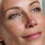 Close-up of a woman's face with a towel on her head, showing skin texture and pores.