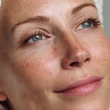 Close-up of a woman's face with a towel on her head, showing skin texture and pores.